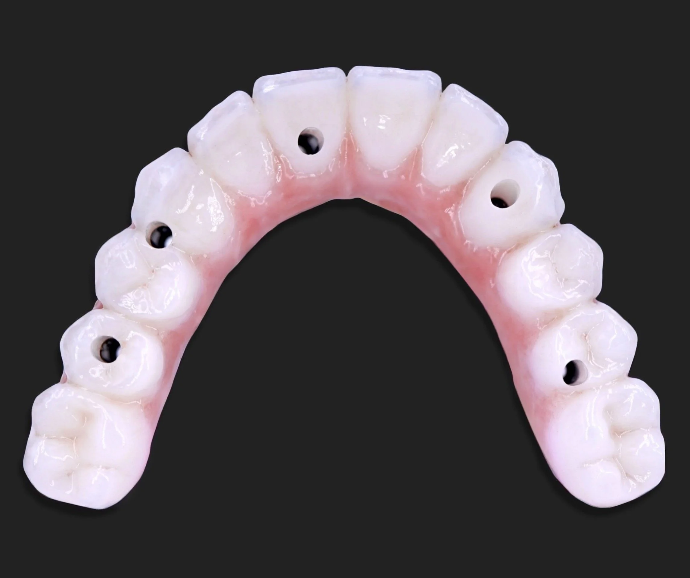 All-on-X Dental Implant Supported Prosthesis (Fixed) - Newport
